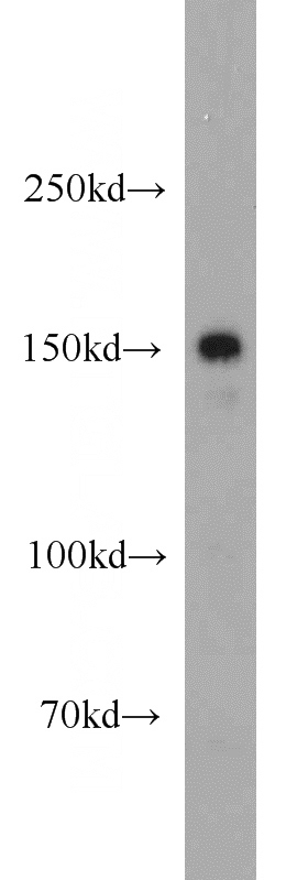 mouse liver tissue were subjected to SDS PAGE followed by western blot with Catalog No:112359(LTBP1 antibody) at dilution of 1:500