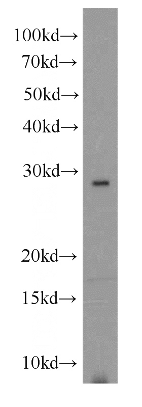 human testis tissue were subjected to SDS PAGE followed by western blot with Catalog No:114726(RNASE11 antibody) at dilution of 1:1000
