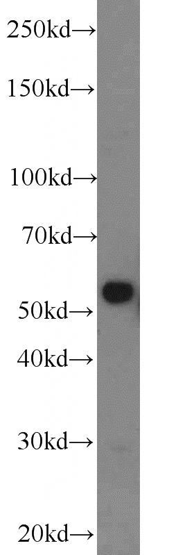 mouse cerebellum tissue were subjected to SDS PAGE followed by western blot with Catalog No:109683(CYP1A1 antibody) at dilution of 1:1000