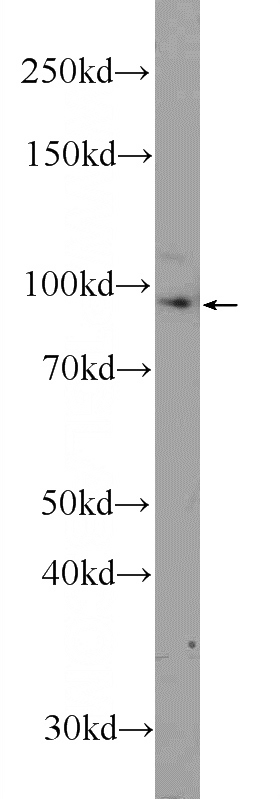 A549 cells were subjected to SDS PAGE followed by western blot with Catalog No:116583(USHBP1 Antibody) at dilution of 1:300