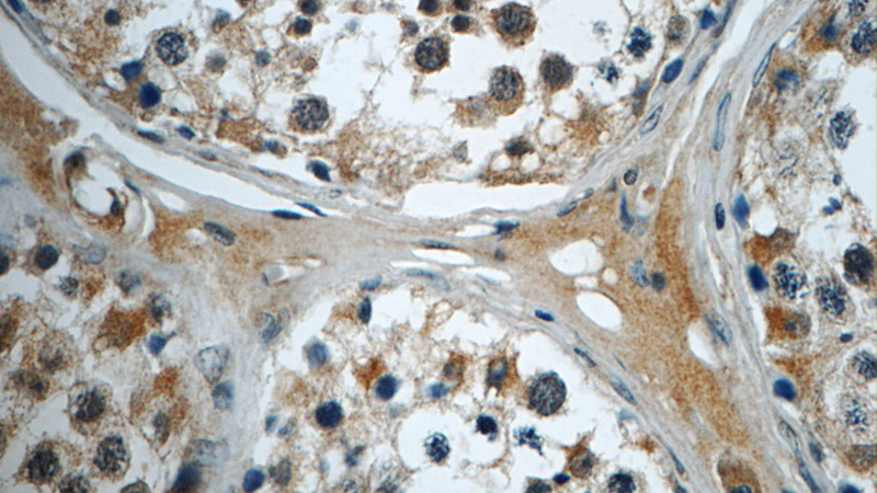 Immunohistochemistry of paraffin-embedded human testis tissue slide using Catalog No:115418(SMAD4 Antibody) at dilution of 1:50 (under 40x lens)