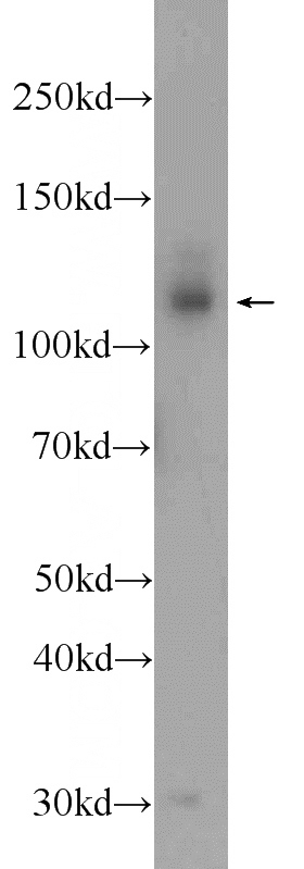 mouse brain tissue were subjected to SDS PAGE followed by western blot with Catalog No:109852(DAB2IP Antibody) at dilution of 1:1000