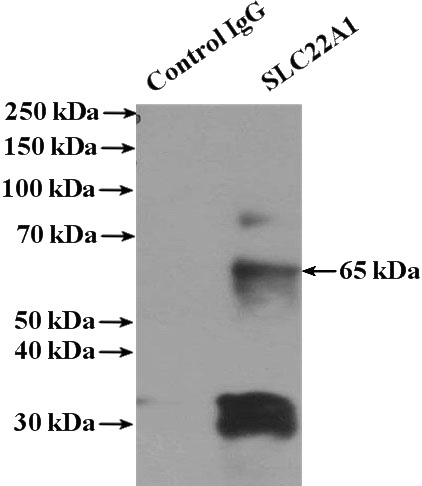 IP Result of anti-SLC22A1 (IP:Catalog No:115312, 4ug; Detection:Catalog No:115312 1:1000) with mouse liver tissue lysate 4000ug.