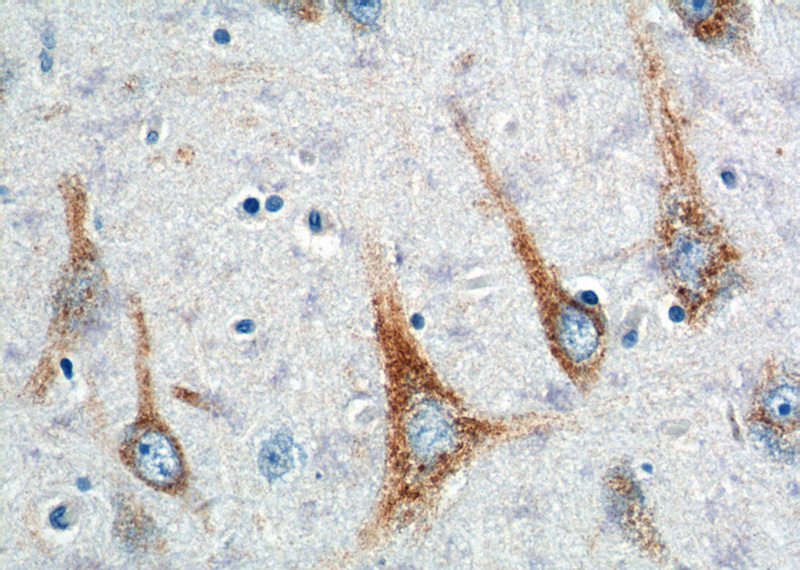 Immunohistochemistry of paraffin-embedded human brain tissue slide using Catalog No:110612(APBB1 Antibody) at dilution of 1:200 (under 40x lens).