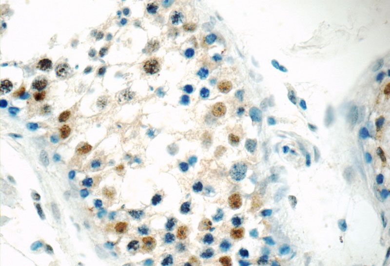 Immunohistochemistry of paraffin-embedded human testis tissue slide using Catalog No:108359(BARHL2 Antibody) at dilution of 1:50 (under 40x lens)