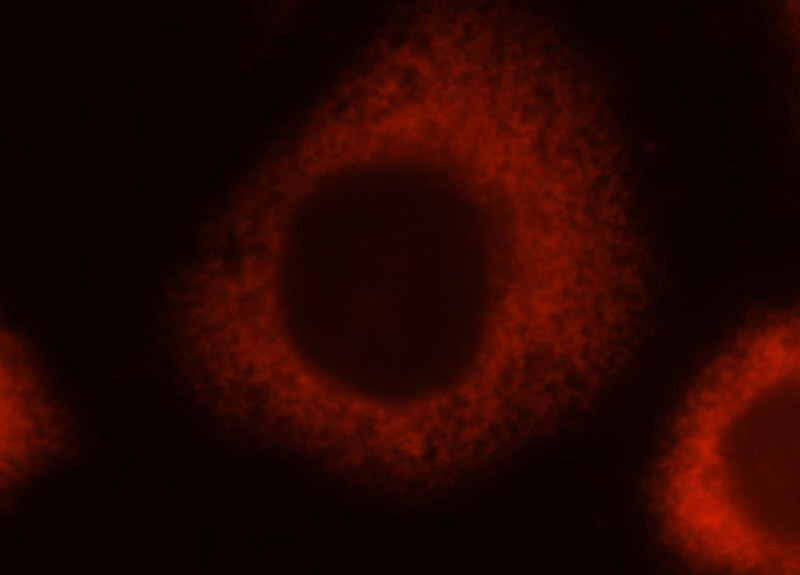 Immunofluorescent analysis of MCF-7 cells, using MYL9 antibody Catalog No:112970 at 1:25 dilution and Rhodamine-labeled goat anti-rabbit IgG (red).