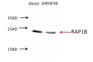 A549 cells were subjected to SDS PAGE followed by western blot with Catalog No:114545(RAP1B antibody) at dilution of 1:300. (Data provided by Angran Biotech (www.miRNAlab.com)).