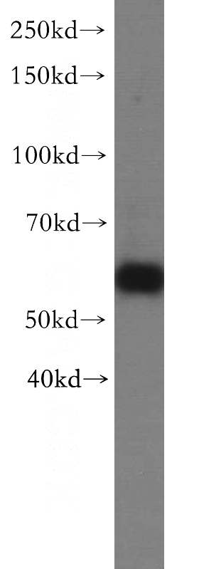 HepG2 cells were subjected to SDS PAGE followed by western blot with Catalog No:114313(PTPIP51 antibody) at dilution of 1:500