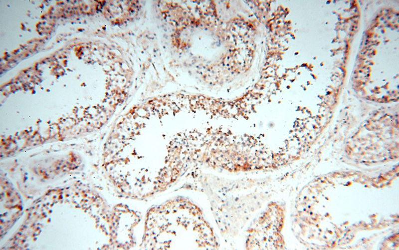 Immunohistochemical of paraffin-embedded human testis using Catalog No:116030(TGM4 antibody) at dilution of 1:100 (under 10x lens)