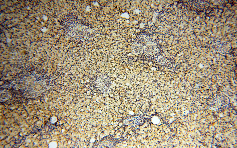 Immunohistochemical of paraffin-embedded human ovary using Catalog No:109766(DCX antibody) at dilution of 1:50 (under 10x lens)