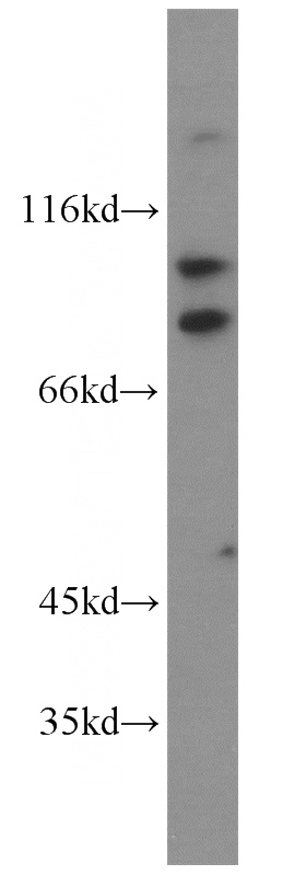 mouse lung tissue were subjected to SDS PAGE followed by western blot with Catalog No:112054(KIFC3 antibody) at dilution of 1:500