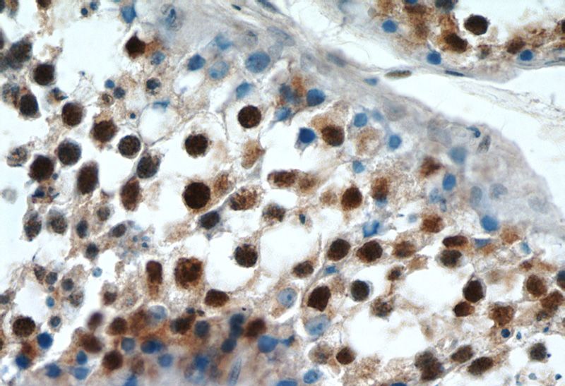 Immunohistochemistry of paraffin-embedded human testis tissue slide using Catalog No:114230(PRPF39 Antibody) at dilution of 1:100 (under 40x lens)