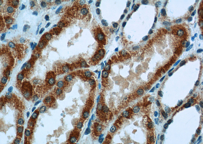 Immunohistochemistry of paraffin-embedded human kidney tissue slide using Catalog No:115031(SDHA Antibody) at dilution of 1:50 (under 40x lens)