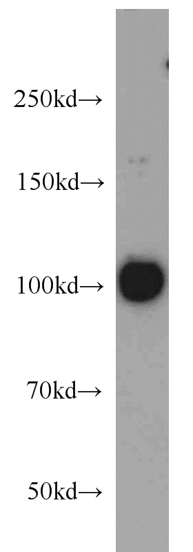 HeLa cells were subjected to SDS PAGE followed by western blot with Catalog No:110507(EXOSC10 antibody) at dilution of 1:1000