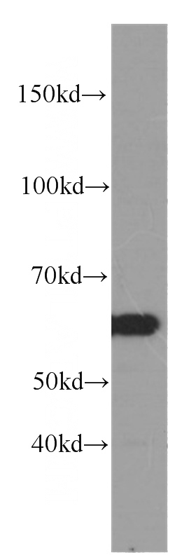 COLO 320 cells were subjected to SDS PAGE followed by western blot with Catalog No:107037(CCT3 antibody) at dilution of 1:1000