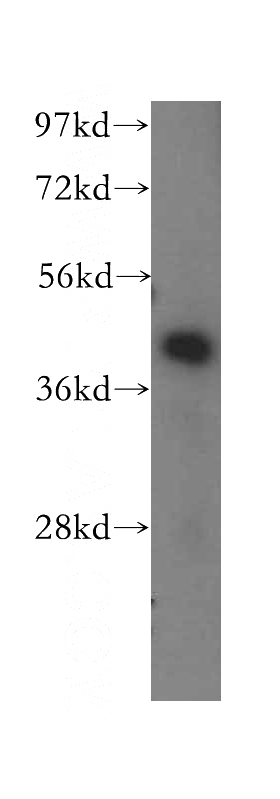 HeLa cells were subjected to SDS PAGE followed by western blot with Catalog No:107824(ACAA2 antibody) at dilution of 1:500