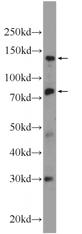 HeLa cells were subjected to SDS PAGE followed by western blot with Catalog No:113909(PNN Antibody) at dilution of 1:600