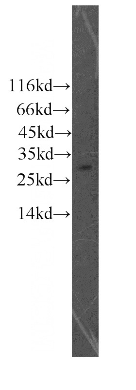 mouse lymph tissue were subjected to SDS PAGE followed by western blot with Catalog No:111323(GZMM antibody) at dilution of 1:500
