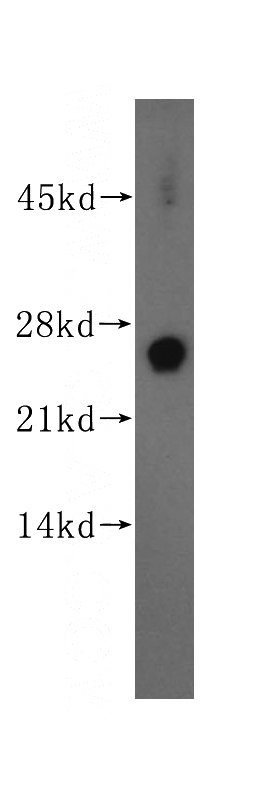 mouse brain tissue were subjected to SDS PAGE followed by western blot with Catalog No:116042(THEM4 antibody) at dilution of 1:500
