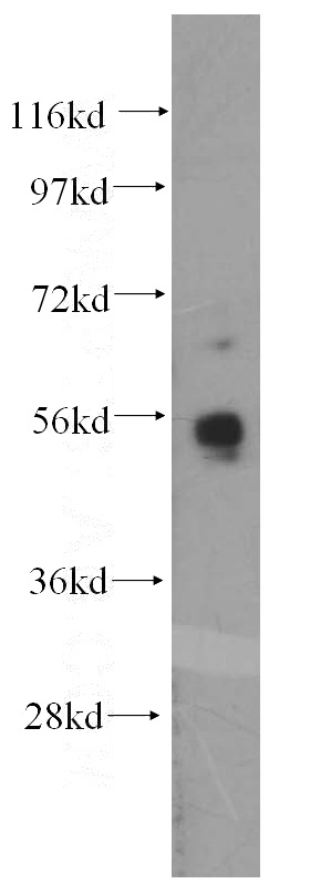 K-562 cells were subjected to SDS PAGE followed by western blot with Catalog No:112495(MATK antibody) at dilution of 1:400