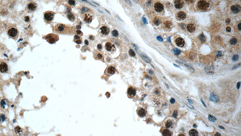 Immunohistochemistry of paraffin-embedded human testis slide using Catalog No:116814(WDR61 Antibody) at dilution of 1:50