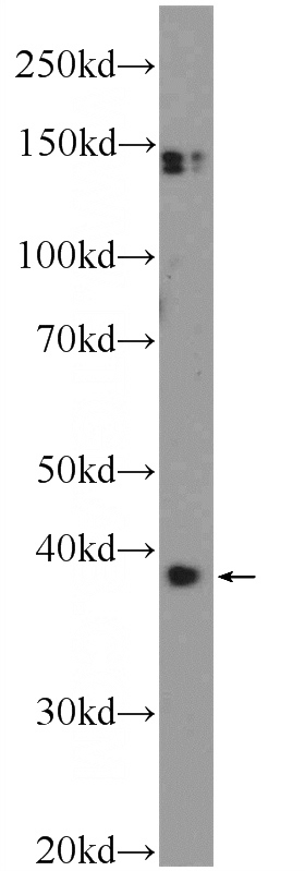 SH-SY5Y cells were subjected to SDS PAGE followed by western blot with Catalog No:110715(FOXR2 Antibody) at dilution of 1:300