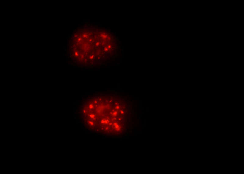 Immunofluorescent analysis of HeLa cells using Catalog No:109666(CCNE2 Antibody) at dilution of 1:50 and Rhodamine-Goat anti-Rabbit IgG