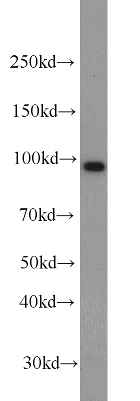 K-562 cells were subjected to SDS PAGE followed by western blot with Catalog No:109315(CILP2 antibody) at dilution of 1:300