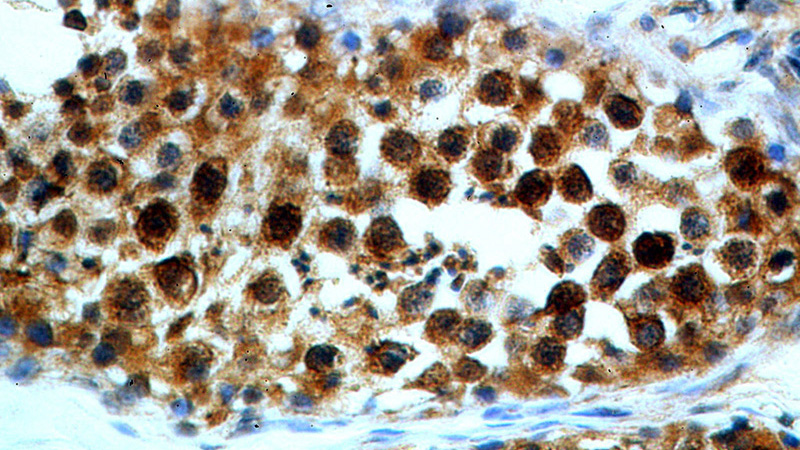 Immunohistochemical of paraffin-embedded human testis using Catalog No:108406(BAG1 antibody) at dilution of 1:50 (under 40x lens)