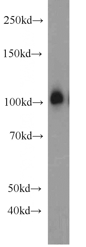 rat brain tissue were subjected to SDS PAGE followed by western blot with Catalog No:110501(EXoc1 antibody) at dilution of 1:1000