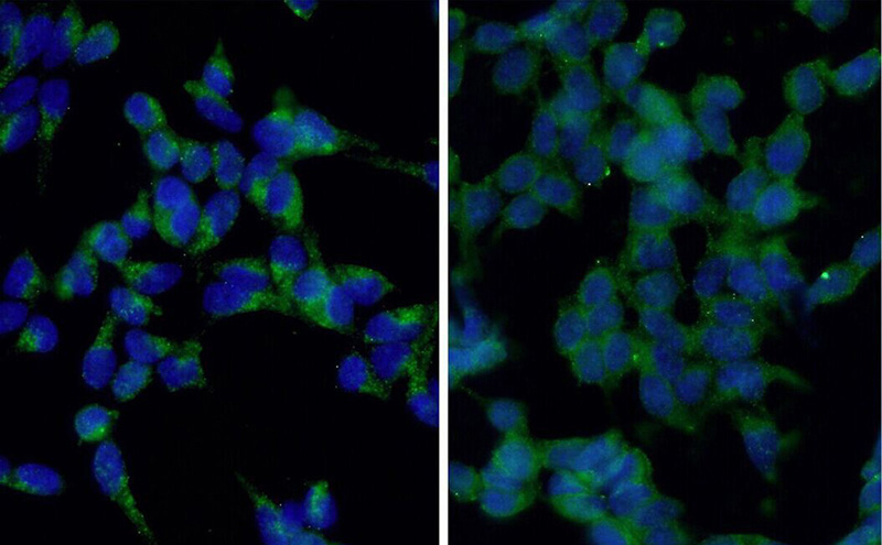 Immunofluorescent analysis of starvation treated HEK-293 cells using Catalog No:112166 (LC3B-Specific Antibody) at dilution of 1:50 and Alexa Fluor 488-congugated AffiniPure Goat Anti-Rabbit IgG(H+L). Cells were fixed with ethanol at -20 °C. 20 mM chloroquine was used to block the autophagy flux.