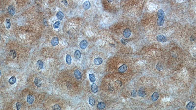 Immunohistochemistry of paraffin-embedded human oesophagus tissue slide using Catalog No:115644(SPRR2D Antibody) at dilution of 1:50 (under 40x lens)