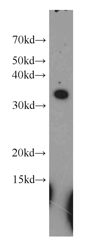 MCF7 cells were subjected to SDS PAGE followed by western blot with Catalog No:114900(RPL7A antibody) at dilution of 1:500
