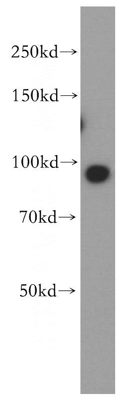 HeLa cells were subjected to SDS PAGE followed by western blot with Catalog No:116157(TNPO2 antibody) at dilution of 1:500