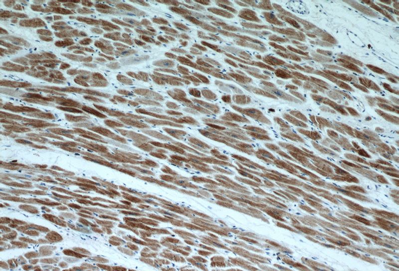 Immunohistochemical of paraffin-embedded human heart using Catalog No:112166 (LC3B-Specific antibody) at dilution of 1:100 (under 10x lens).