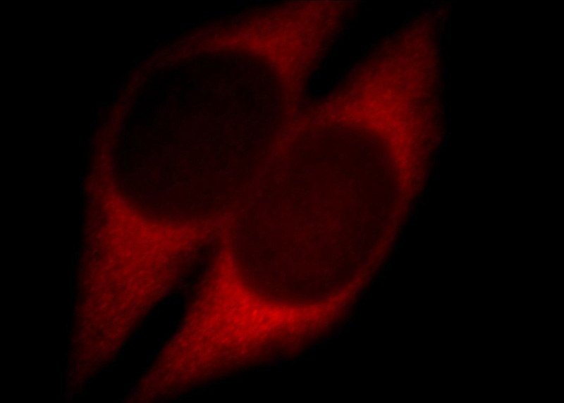 Immunofluorescent analysis of Hela cells, using ZCCHC11 antibody Catalog No:116933 at 1:25 dilution and Rhodamine-labeled goat anti-rabbit IgG (red).