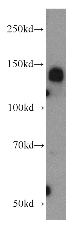HL-60 cells were subjected to SDS PAGE followed by western blot with Catalog No:109188(CEP97 antibody) at dilution of 1:1000