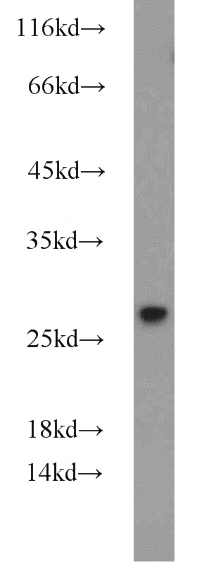 HEK-293 cells were subjected to SDS PAGE followed by western blot with Catalog No:111200(GRB2 antibody) at dilution of 1:1000