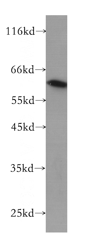 PC-3 cells were subjected to SDS PAGE followed by western blot with Catalog No:107493(RABEP2 antibody) at dilution of 1:300