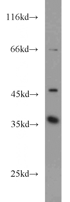 Jurkat cells were subjected to SDS PAGE followed by western blot with Catalog No:109165(CDK6 antibody) at dilution of 1:500