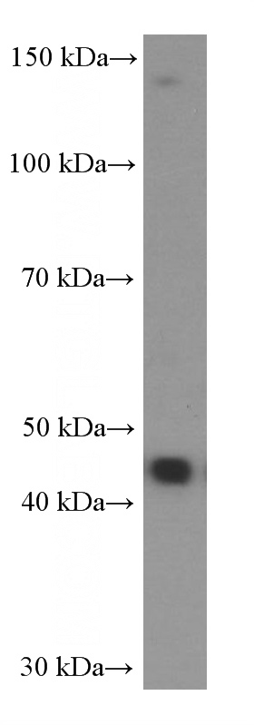 Jurkat cells were subjected to SDS PAGE followed by western blot with Catalog No:107334(NOB1 Antibody) at dilution of 1:3000