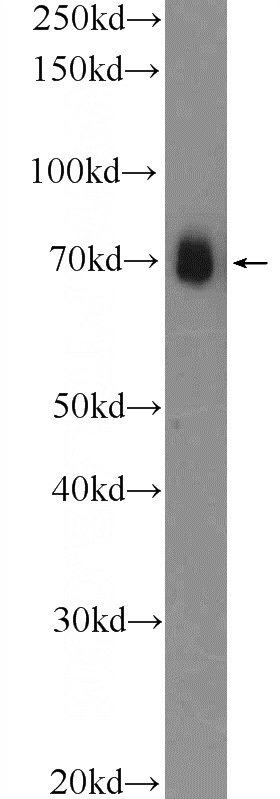 HEK-293 cells were subjected to SDS PAGE followed by western blot with Catalog No:110795(FUS/TLS Antibody) at dilution of 1:2000