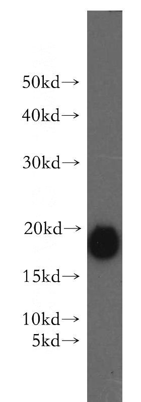 Recombinant protein were subjected to SDS PAGE followed by western blot with Catalog No:114305(PTH-Specific antibody) at dilution of 1:500