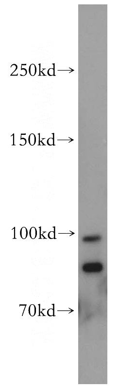 mouse colon tissue were subjected to SDS PAGE followed by western blot with Catalog No:116411(TRPM5 antibody) at dilution of 1:1000
