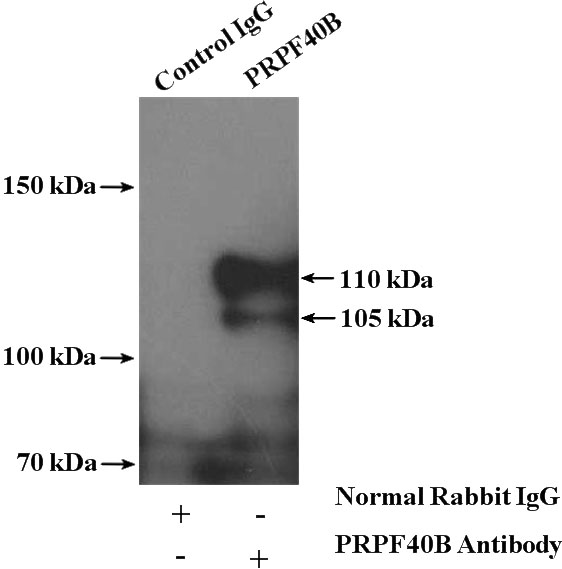 IP Result of anti-PRPF40B (IP:Catalog No:114233, 4ug; Detection:Catalog No:114233 1:2000) with Y79 cells lysate 800ug.