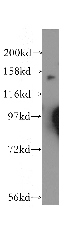human brain tissue were subjected to SDS PAGE followed by western blot with Catalog No:110827(GAK antibody) at dilution of 1:500
