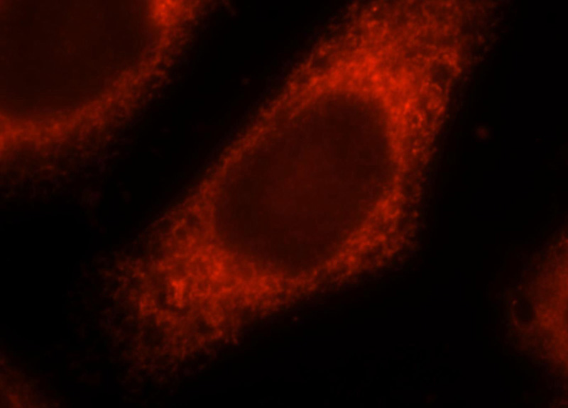 Immunofluorescent analysis of MCF-7 cells, using LPCAT1 antibody Catalog No:112300 at 1:25 dilution and Rhodamine-labeled goat anti-rabbit IgG (red).