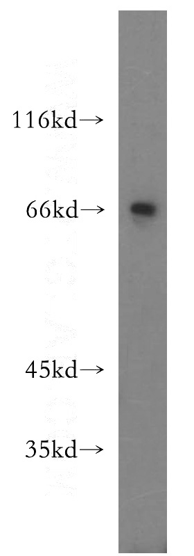 HeLa cells were subjected to SDS PAGE followed by western blot with Catalog No:112784(MTMR15 antibody) at dilution of 1:300