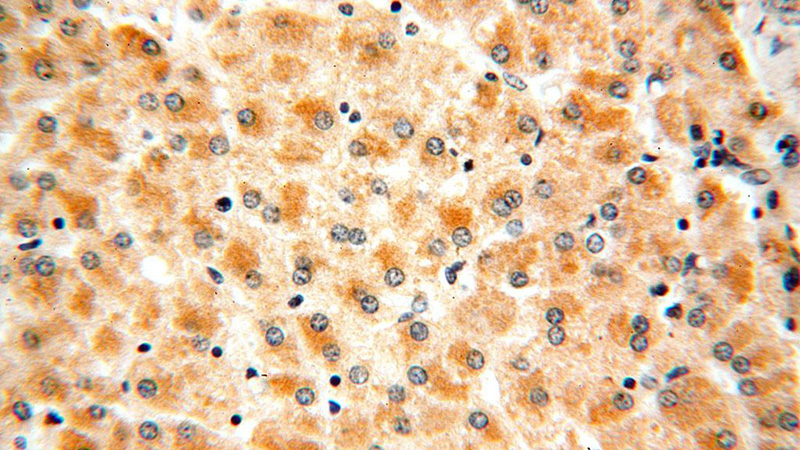 Immunohistochemical of paraffin-embedded human liver using Catalog No:109222(CHDH antibody) at dilution of 1:100 (under 40x lens)