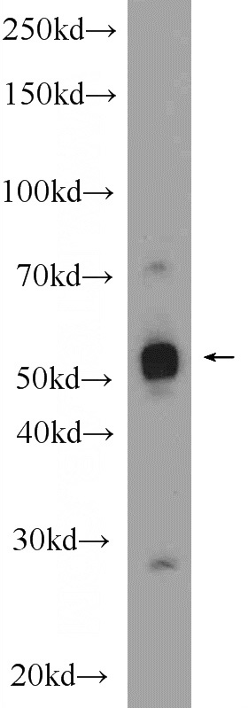 rat colon tissue were subjected to SDS PAGE followed by western blot with Catalog No:113448(NUSAP1 Antibody) at dilution of 1:1000